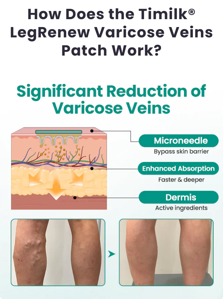 Varicose Vein Relief Patch